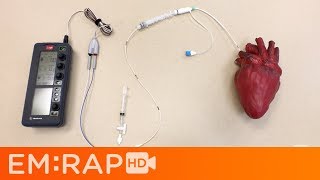 Placing a Transvenous Pacemaker [upl. by Aidam]