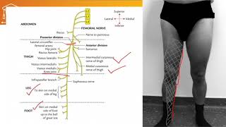 femoral and obturator nerve injury [upl. by Sophey142]