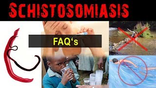 Why amp what is schistosomiasis   FAQ [upl. by Mendive483]