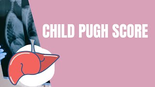 Child Pugh Score A Liver Function Test [upl. by Krishnah]