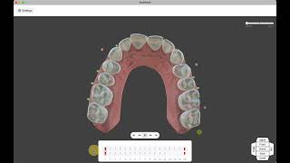 ArchForm Aligner Design Software [upl. by Lagasse]