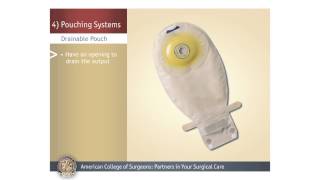 Colostomy Care Teaching Video [upl. by Pansie]