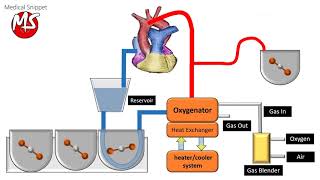 Cardiopulmonary bypass CPB circuit [upl. by Ahsim]