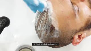 How to wash your hair after hair transplant  Antalya  DK Klinik [upl. by Eirffej]