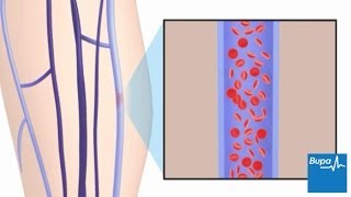 Phlebotomy The Order of Veins [upl. by Dnomasor]