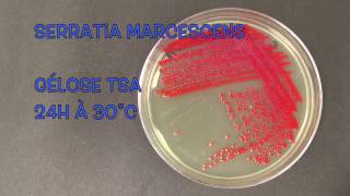 Serratia marcescens [upl. by Fleisig]