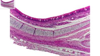 Trachea overview [upl. by Octavie]