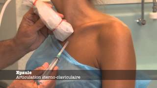 Echomsinfo  Articulation sternoclaviculaire [upl. by Eustacia]