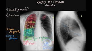 Radio du thorax  Introduction  Partie 1  Docteur Synapse [upl. by Draude]