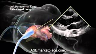 Cardiac Cycle and Conduction System of Heart Physiology Animation [upl. by Flanders]