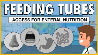 Types of Feeding Tubes EXPLAINED [upl. by Yelrahc]