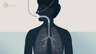 Bronchoscopy  examination of your airways English version [upl. by Lebam149]