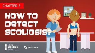 Ch2  How to detect scoliosis [upl. by Schecter326]