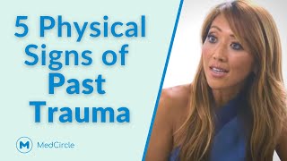 5 Physical Signs of Past Trauma That Most People Miss [upl. by Whitby]