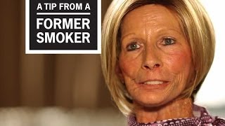 CDC Tips From Former Smokers  Terrie H Little Things I Miss [upl. by Aspasia]