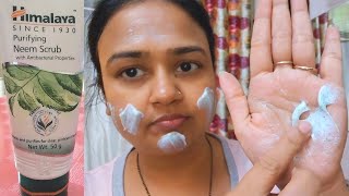 Himalaya Neem Purifying Scrub Review amp Demo  Himalaya Neem Scrub for Acne Pimples [upl. by Blas]