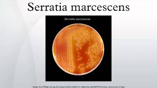 Serratia marcescens [upl. by Hersh303]