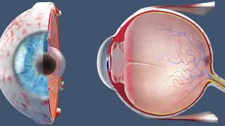 Cataract Surgery  Inside the OR [upl. by Naitsirc]