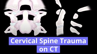 Anatomy Tutorial  The Vertebral Artery [upl. by Coppola]