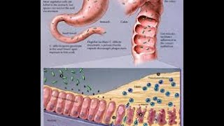 Clostridium Difficile [upl. by Hirza]