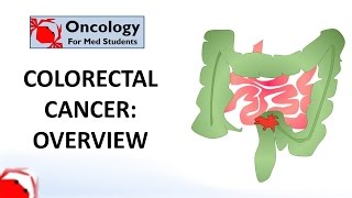 Colorectal Cancer An overview [upl. by Jerome]