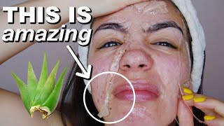 I Used ALOE VERA On My Skin For 5 Days amp This Is What Happened [upl. by Anette]