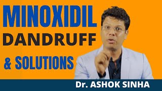 Minoxidil Dandruff And Solutions  Dr Ashok Sinha [upl. by Elocon]