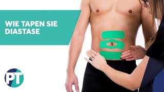 Wie tapen Sie Diastase  Medical Taping  PhysioTape [upl. by Aicad]