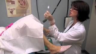 Gynecologist Common Procedures Explained [upl. by Eisserc]