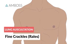 Fine Crackles Rales  Lung Auscultation  Episode 2 [upl. by Nitsua]