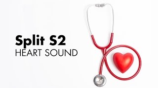 Fixed Split S2  Heart Sounds  MEDZCOOL [upl. by Ahtamat]