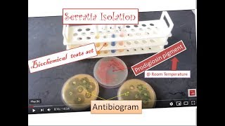 Serratia  the simplest way of identification and isolation from specimens  Serratia marcescens [upl. by Talich539]