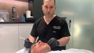 How to Get Rid of Acne Scars  Dermal FillerSubcision  Acne Scar Combination Tx  Part 1  Dr Emer [upl. by Emelen]