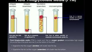 Basics of Fluid Thioglycollate Media FTM  With Examples [upl. by Ylrebma]