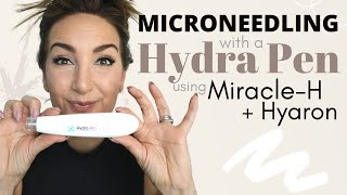 MICRONEEDLING WITH A HYDRA PEN USING MIRACLEH  HYARON [upl. by Eidnim]