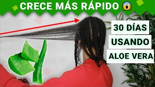 SABILA Para El CRECIMIENTO DEL CABELLO 😱 ANTES Y DESPUÉS  Funciona 🤔 [upl. by Miharbi]