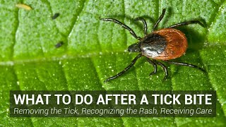 What to Do After a Tick Bite  Johns Hopkins Lyme Disease Research Center [upl. by Erihppas]