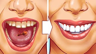 How To REMOVE PLAQUE amp TARTAR From Teeth At Home Naturally [upl. by Adekram]