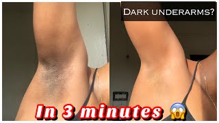 How to Get rid of Dark underarms in 3 minutes instant result [upl. by Verney]