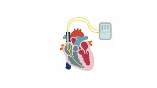 Assessing tricuspid valve stenosis [upl. by Foley]