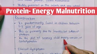 Protein  Energy Malnutrition  Kwashiorkor  Marasmus  Biochemistry [upl. by Nnaeilsel]