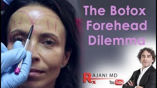 Botox Forehead Dilemma Explained Dr Rajani [upl. by Dionisio313]