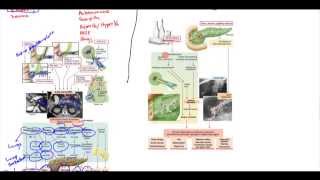 TMT CT Acute Pancreatitis Atlanta Classification by Dr Ankur Shah [upl. by Farrah]