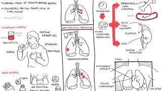 Health Anxiety  How To Do Treatment [upl. by Dnomsad872]