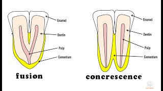 Developmental disturbances in shape of teeth  Part 1 [upl. by Rugen191]