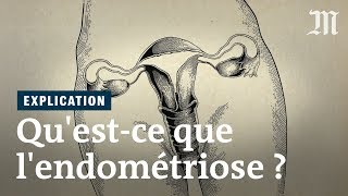 Endometriose  Diagnose und Therapie in der Frauenklinik des UniKlinikums Erlangen [upl. by Ssalguod]