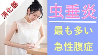 【5分医学】急性虫垂炎（盲腸）消化器 [upl. by Naylor]