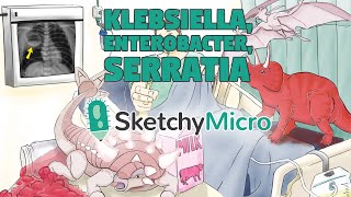 Klebsiella Enterobacter Serratia  SketchyMicro  Sketchy Medical USMLE Step 1 [upl. by Nedap478]