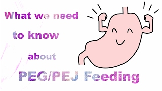 What we need to know about PEGPEJ feeding [upl. by Akenahs]