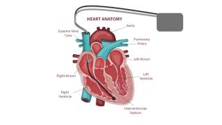 Pacemaker Issues Explained Part 2 Decoding Undersensing [upl. by Wallach]